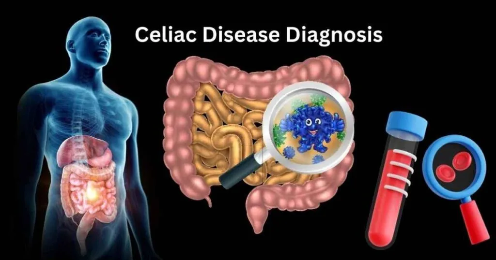 Celiac Disease Diagnosis Tests Steps and What to Expect